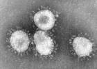 Grippe A/H1N1, la France a le virus du Tamiflu